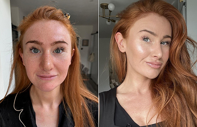 Žena po plastice čelí urážkám, podle lidí je sobecká