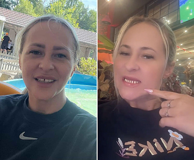 Žena si vysnila dokonalý chrup, dočkala se ho až po měsících trápení